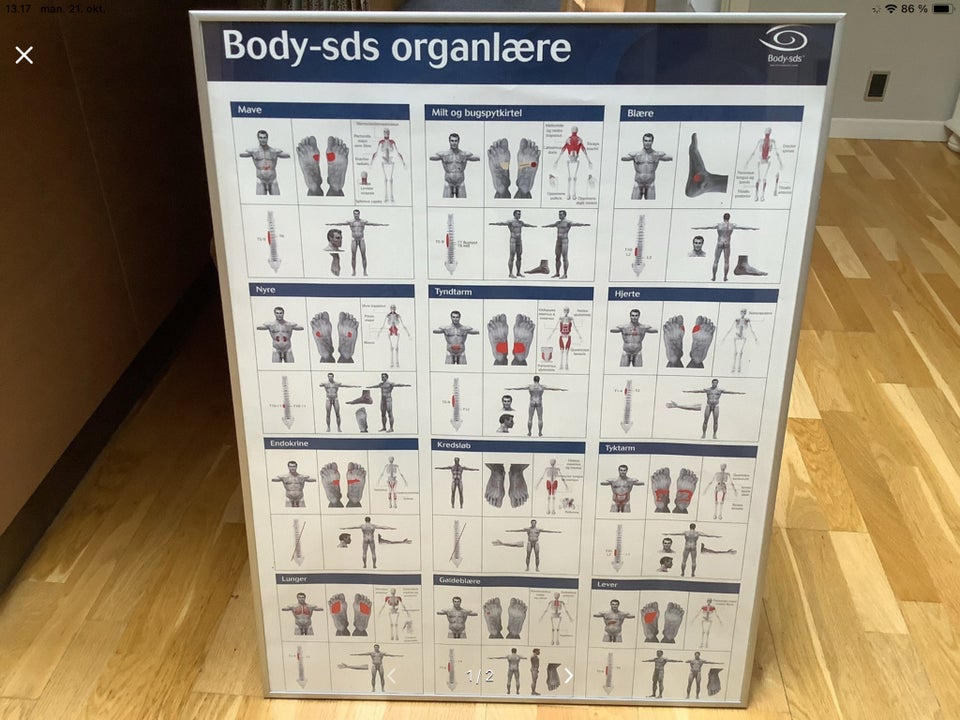 Body sds organlærer, Body-sds, Organernes opbygning